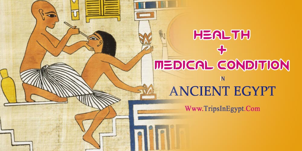 Health in Ancient Egypt - The Daily Life of Ancient Egyptian - Trips in Egypt